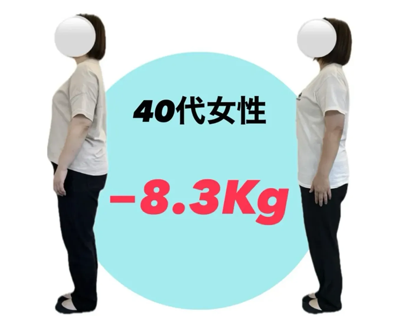 30代女性のビフォーアフター写真