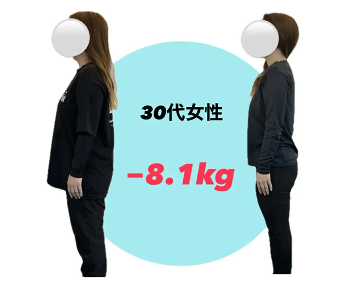 30代女性のビフォーアフター写真