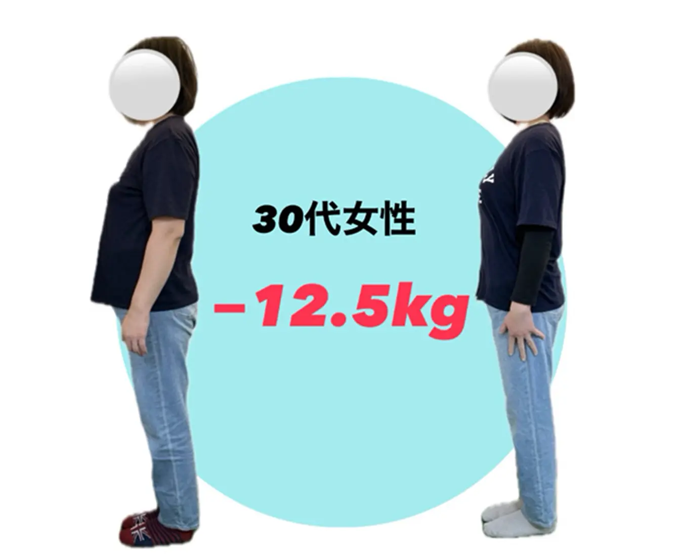 30代女性のビフォーアフター写真